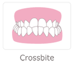 Crossbite