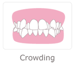Crowding