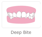 Deep Bite